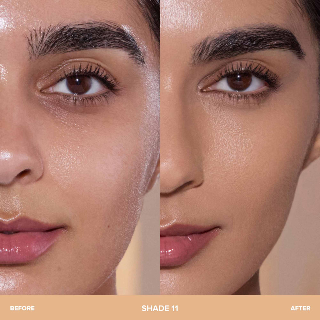 11 | Before and After 11